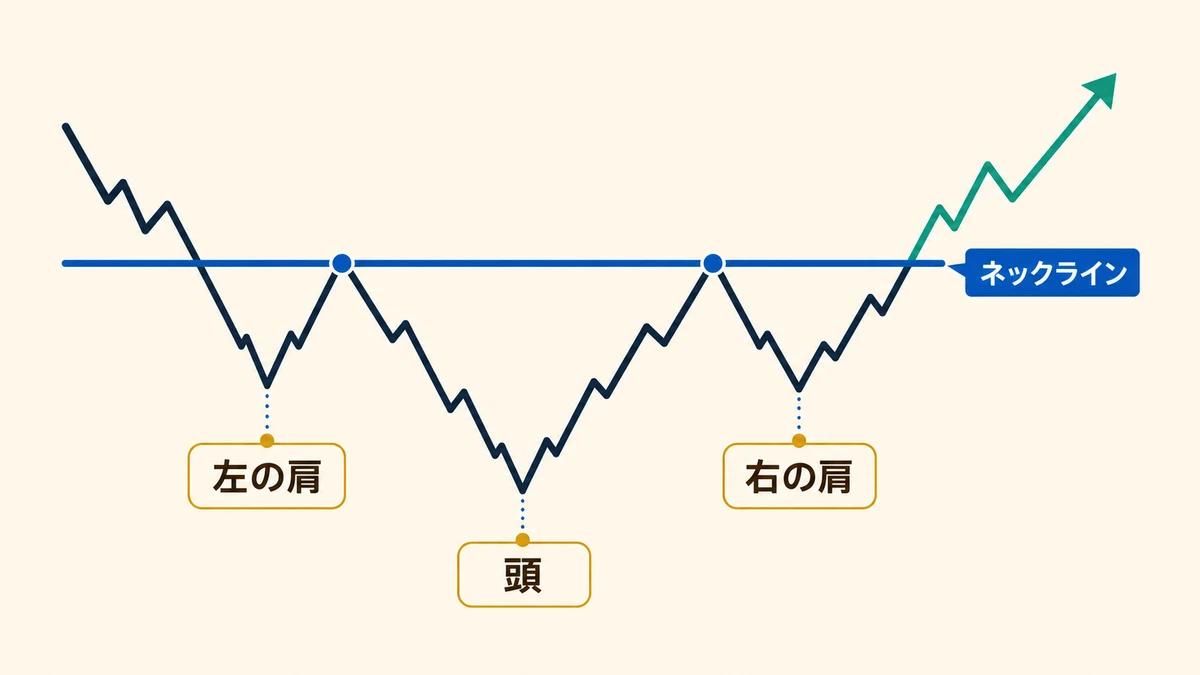 逆三尊の基本構造